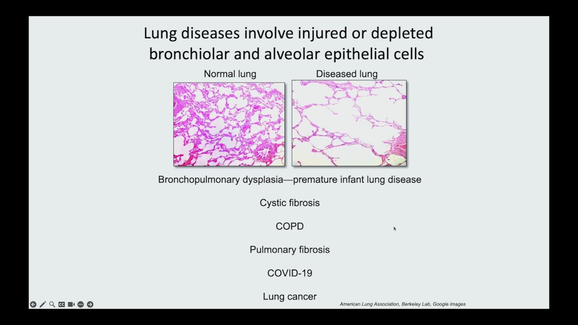 Thumbnail image for UCTV: Regulation of Lung Progenitors in Homeostasis and Injury Repair - Carla Kim, Sanford Stem Cell Symposium 2023