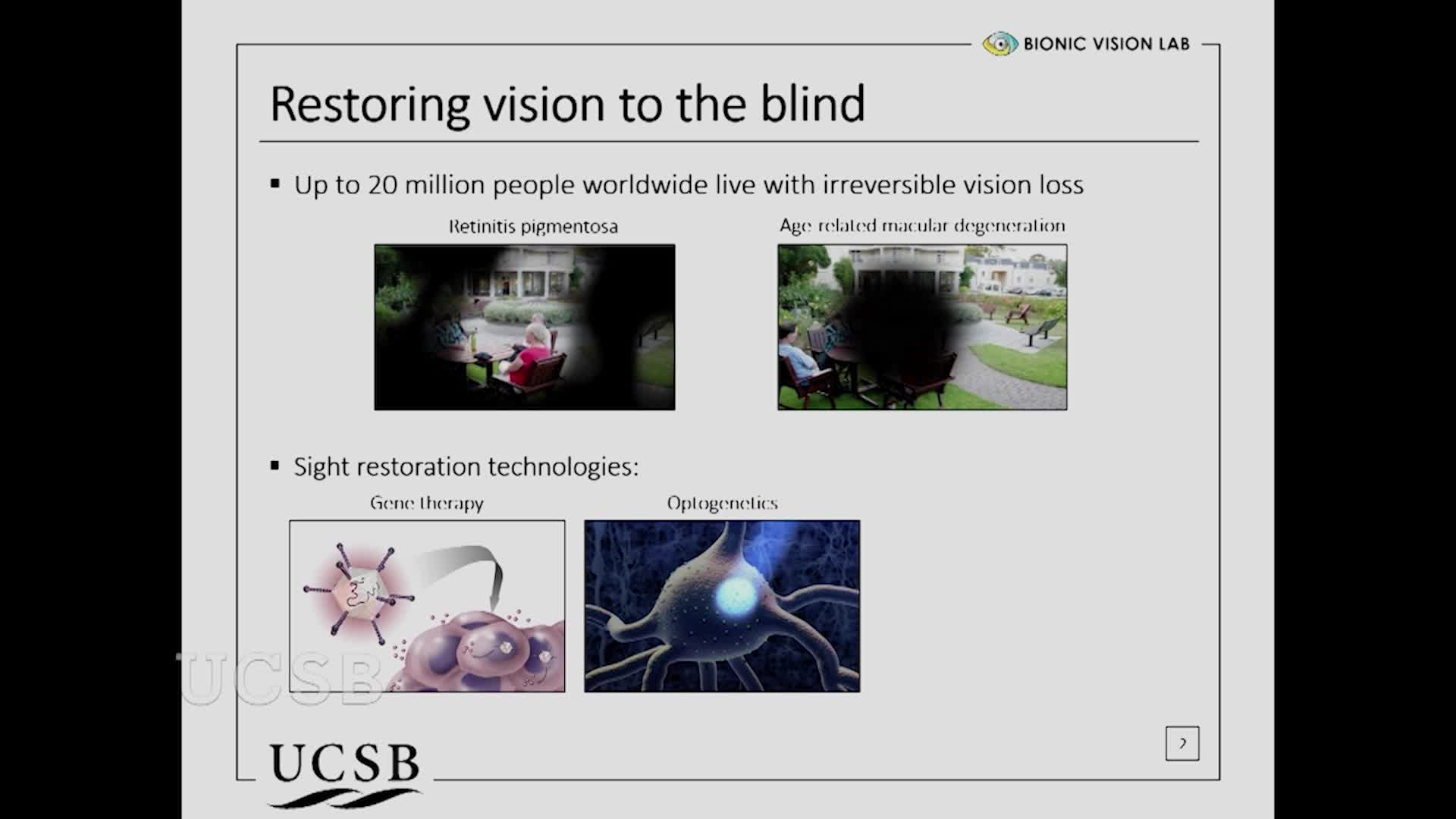 Thumbnail image for UCTV: Learning to See Again with a Bionic Eye