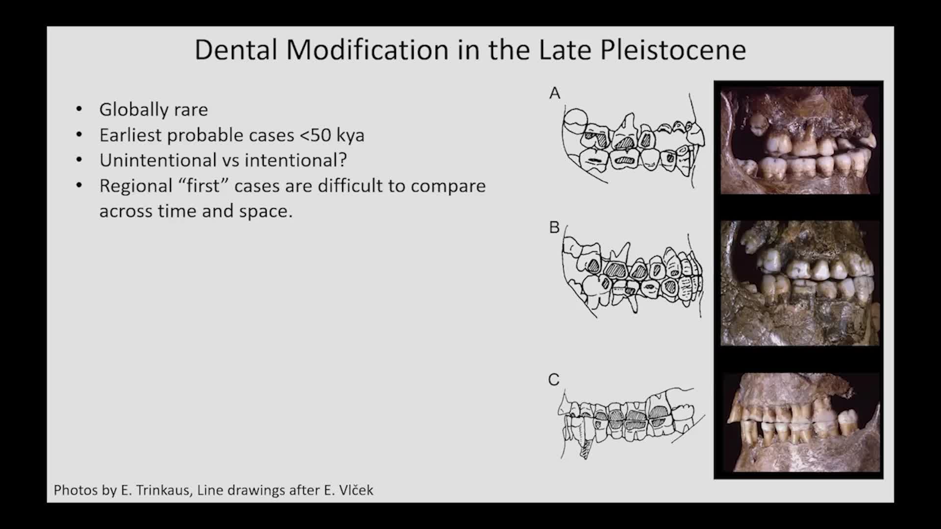 Thumbnail image for UCTV: CARTA: Dental Ablation and Facial Piercing in Late Pleistocene Southwestern Asia and Africa with John Willman