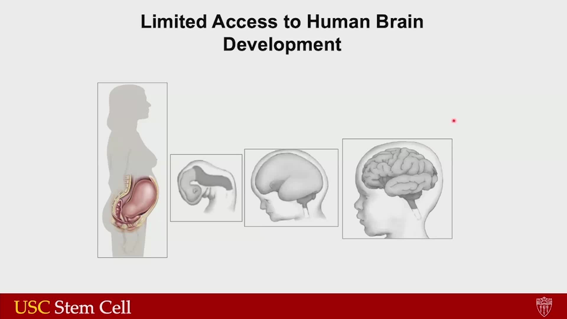 Thumbnail image for UCTV: Upgrading the Physiological Relevance of Human Brain Organoids