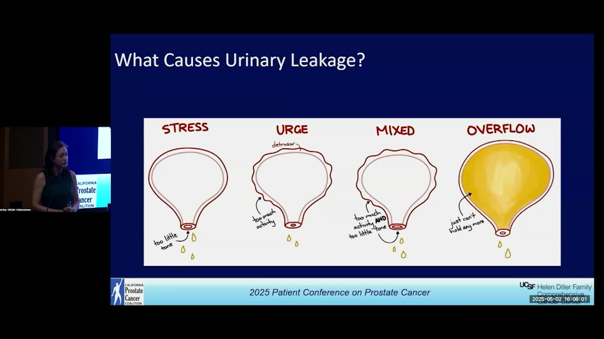 Thumbnail image for UCTV: Prostate Cancer Survivorship: Urinary and Sexual Wellness