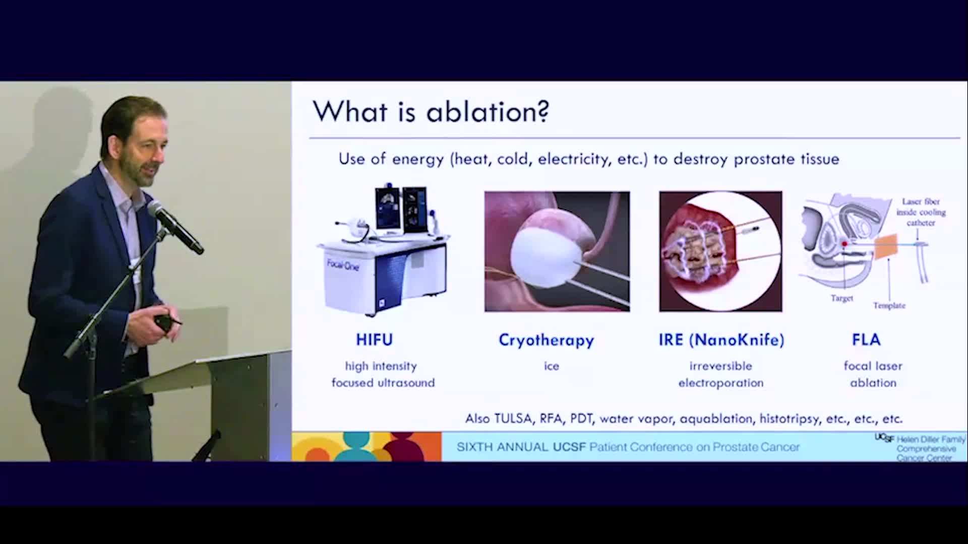 Thumbnail image for UCTV: Focal Therapy for Prostate Cancer: Why, Who, and How?